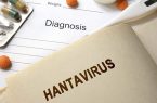 علائم و نشانه های هانتا ویروس که بعد از کرونا پیدا شد چیست؟