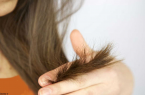 موخوره را بدون کوتاه‌کردن مو درمان کنید